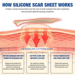 Mitreal scar sheets close-up in medical-grade silicone for sensitive skin