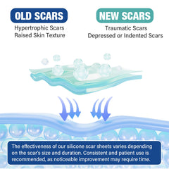 Mitreal scar sheets washable and reusable for cost-effective care