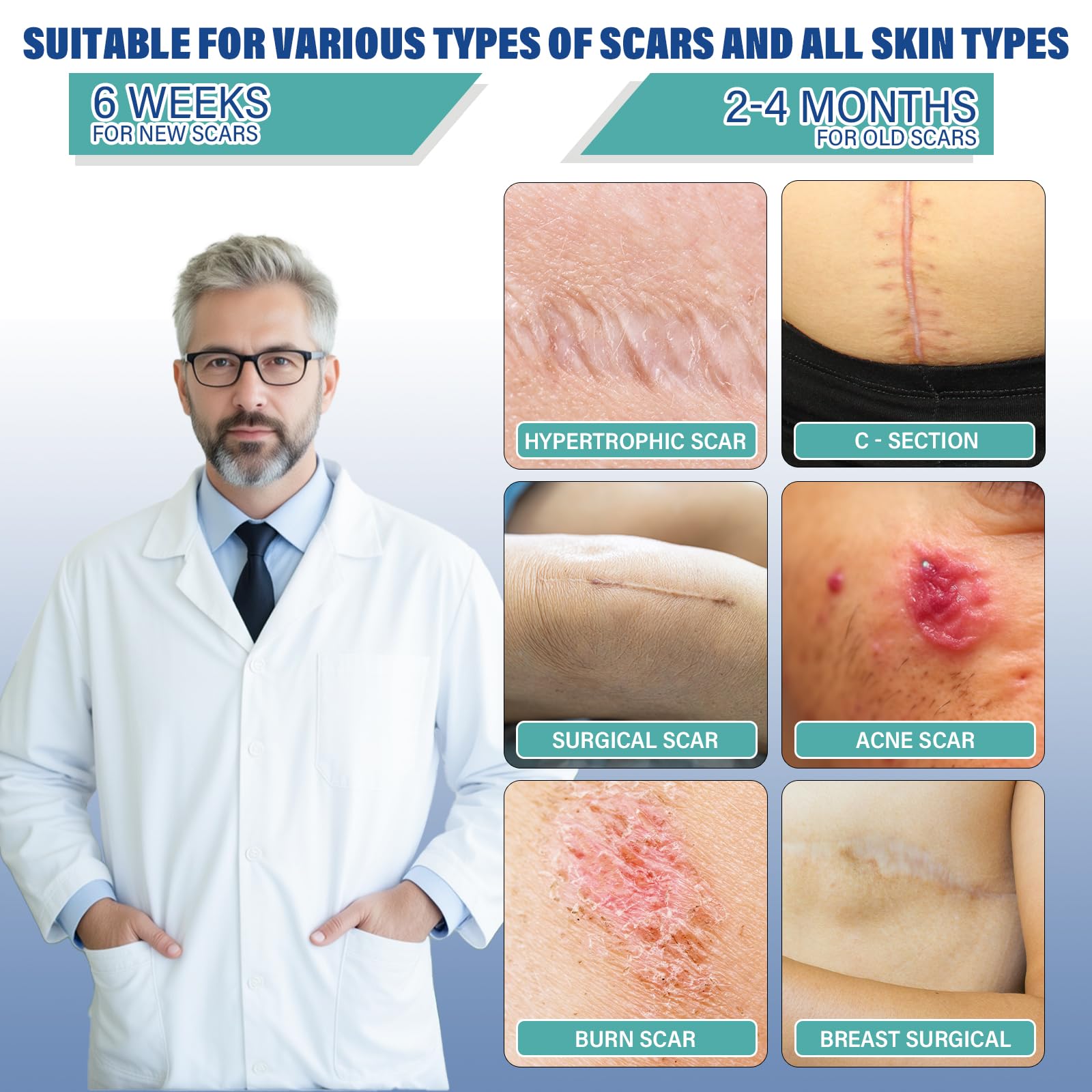 Mitreal silicone scar sheet on skin shows discreet daily wear