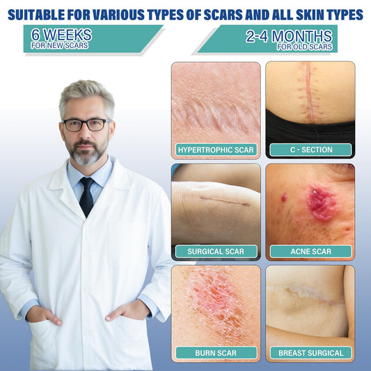 Mitreal silicone scar sheet on skin shows discreet daily wear