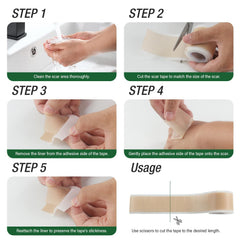 Mitreal silicone scar sheets depicted in a clinical setting reflecting professional use
