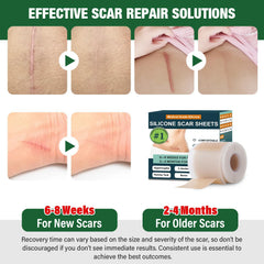 Mitreal silicone scar sheets roll close-up showing extended-use roll