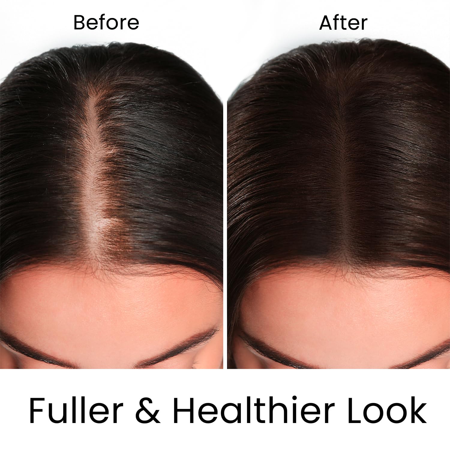 MOEHAIR Rosemary extract spotlight emphasizing scalp health.