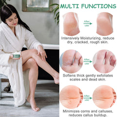 MOKYDUO Urea 40% foot cream on heels for smoother skin.