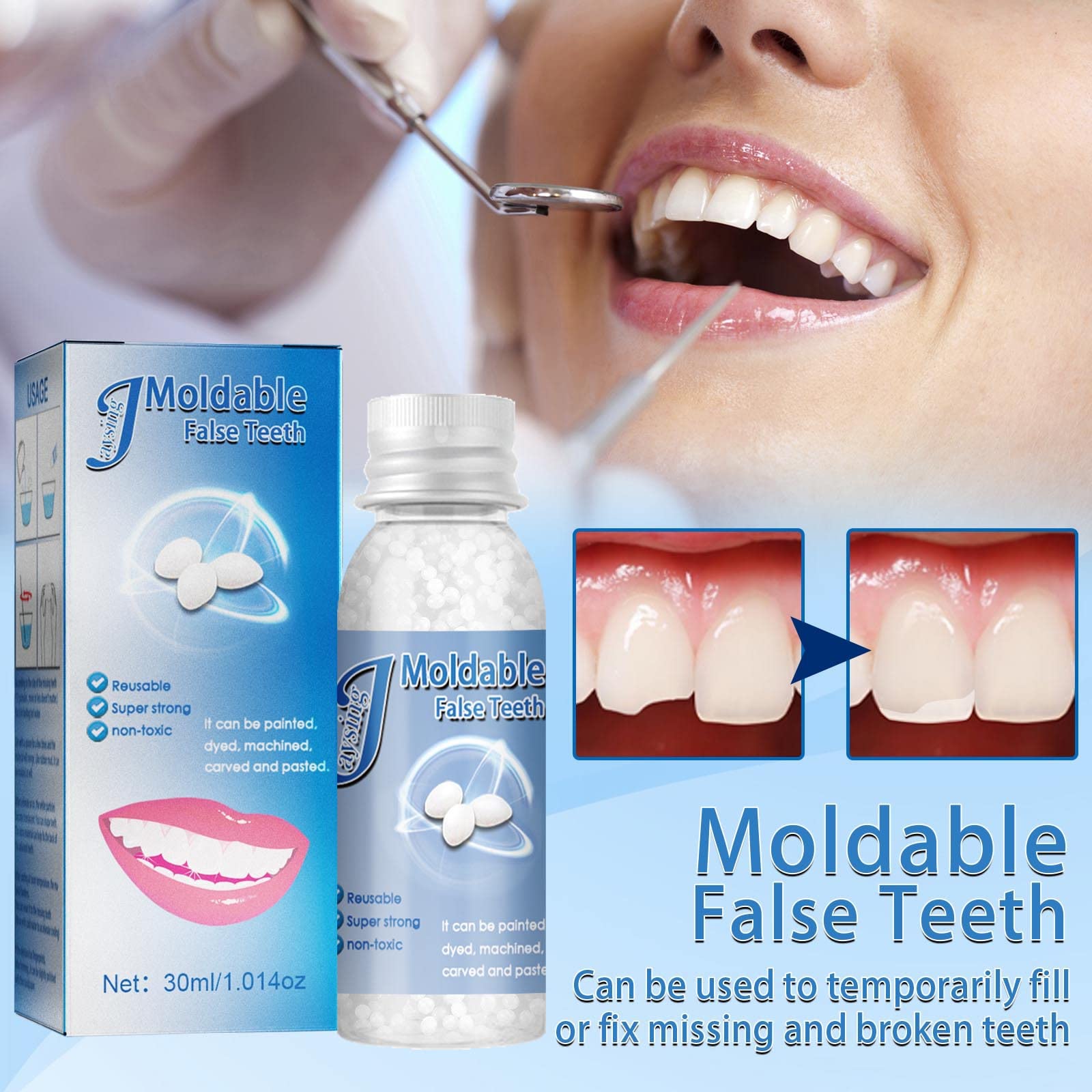Moldable denture repair beads for natural look