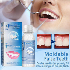Moldable denture repair beads for natural look