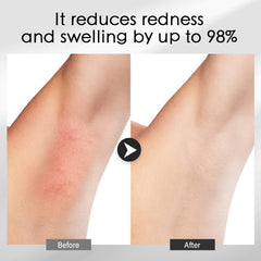 MOSRROU cooling gel forms protective barrier against heat exposure on skin