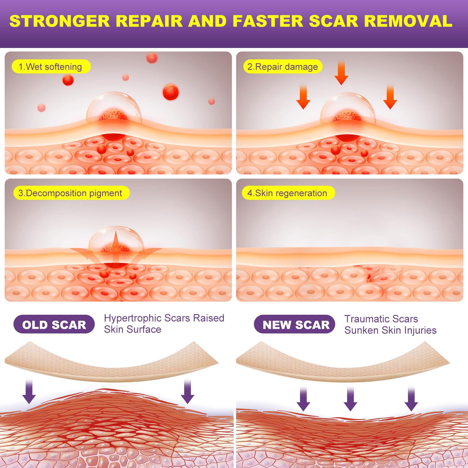 MUKBEA scar sheets cut-to-fit accurately covers scar area for comfort.