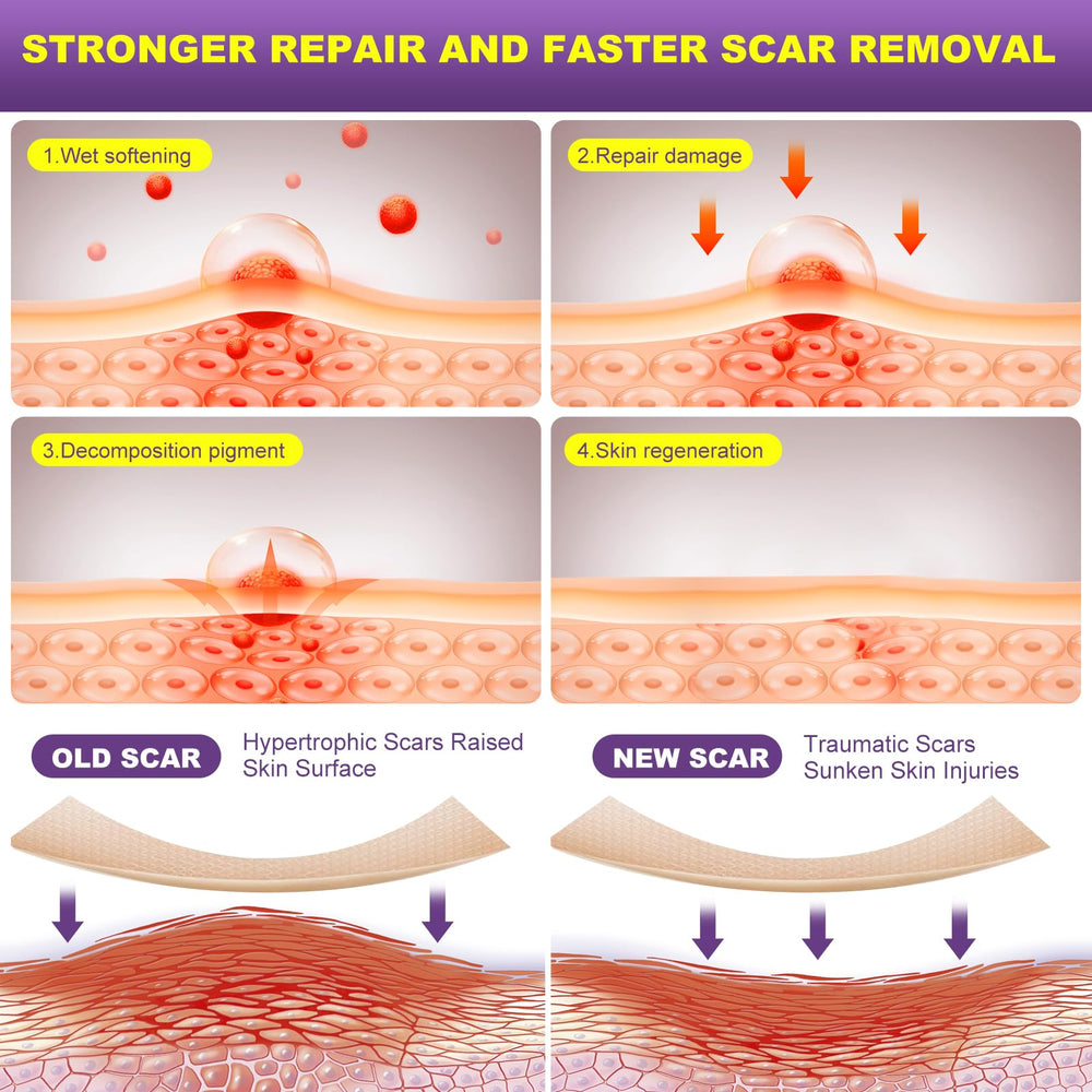 MUKBEA scar sheets cut-to-fit accurately covers scar area for comfort.