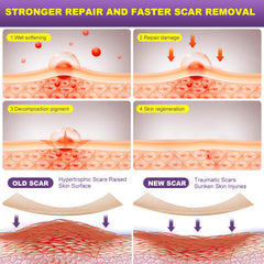 MUKBEA scar sheets cut-to-fit accurately covers scar area for comfort.