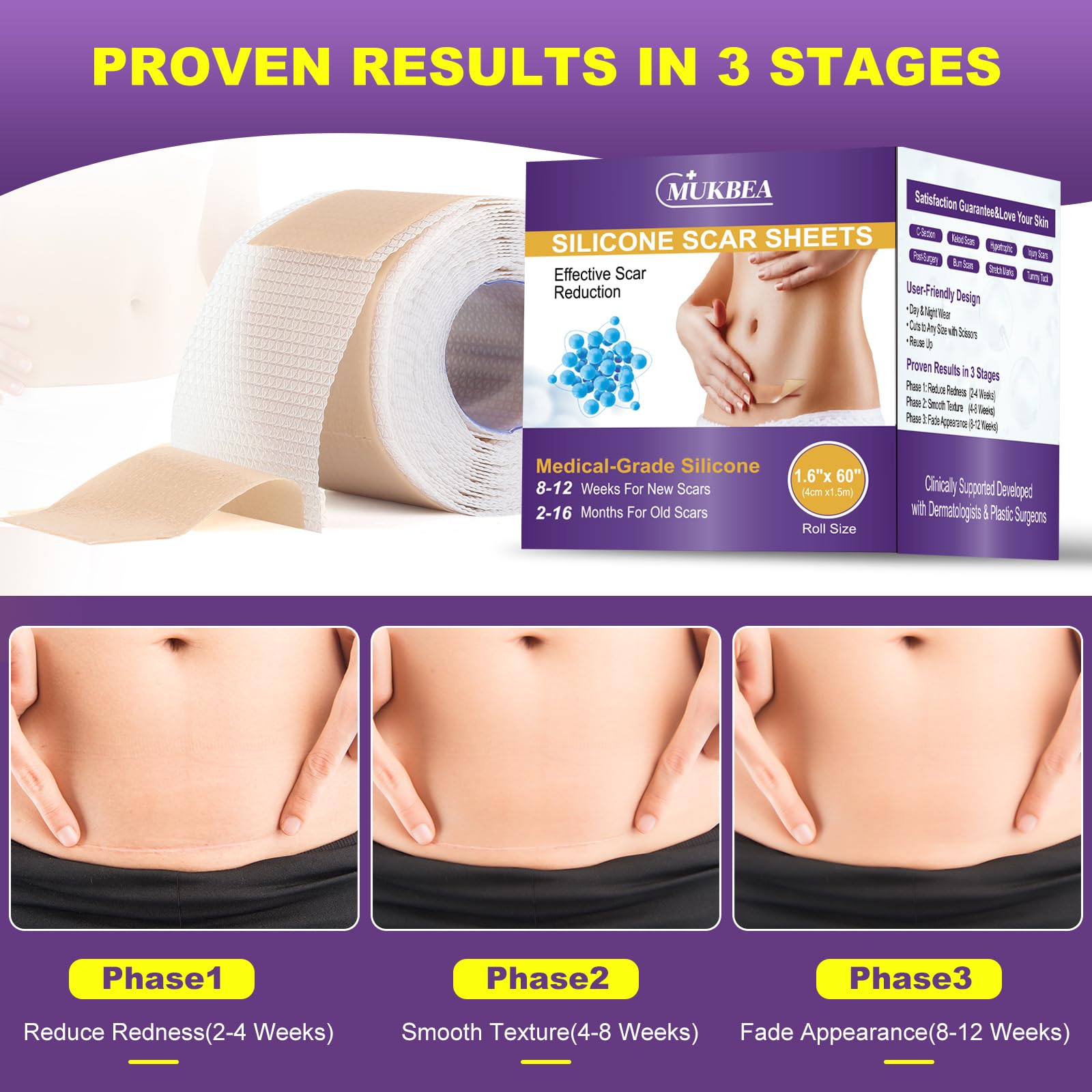 MUKBEA silicone scar sheets are reusable for ongoing use.