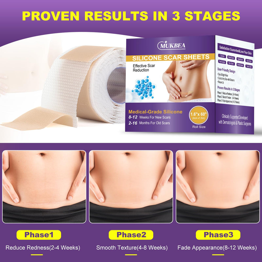MUKBEA silicone scar sheets are reusable for ongoing use.