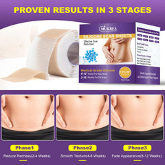 MUKBEA silicone scar sheets are reusable for ongoing use.