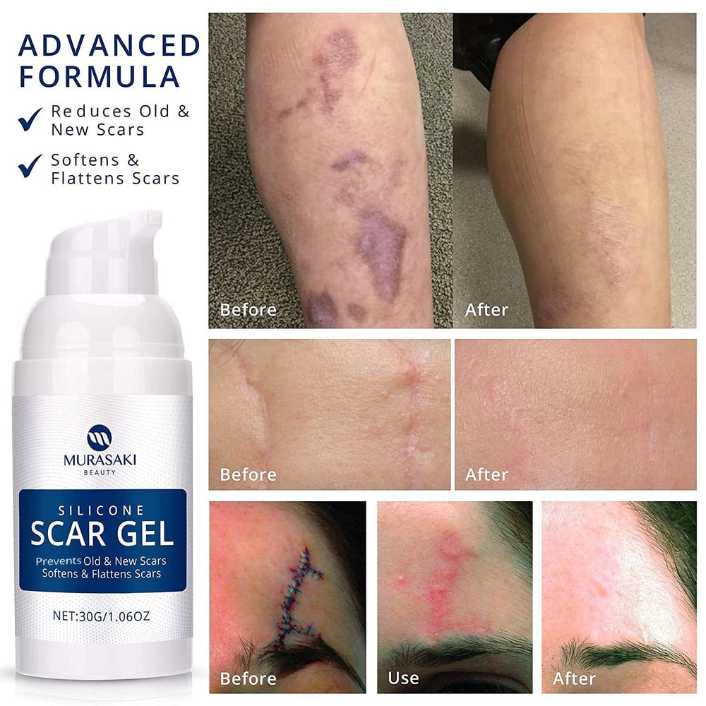 MURASAKI BEAUTY scar gel hand-massage demonstrates gentle application for scar care