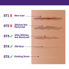 MURASAKI BEAUTY scar gel on skin near healing area.