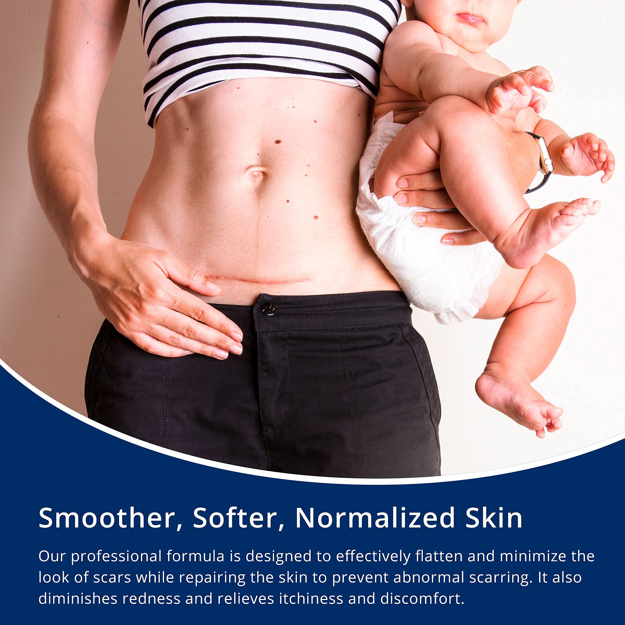 MURASAKI BEAUTY scar gel on skin with a new scar shows potential improvement