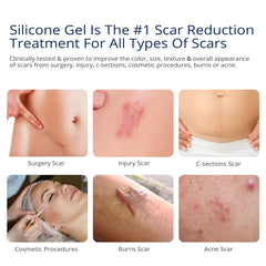 MURASAKI BEAUTY scar gel texture close-up shows non-greasy formula for daily use