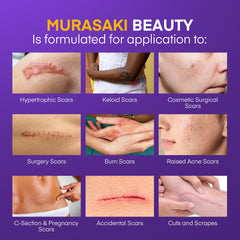 MURASAKI BEAUTY silicone scar gel texture close-up shows lightweight, comfortable application.