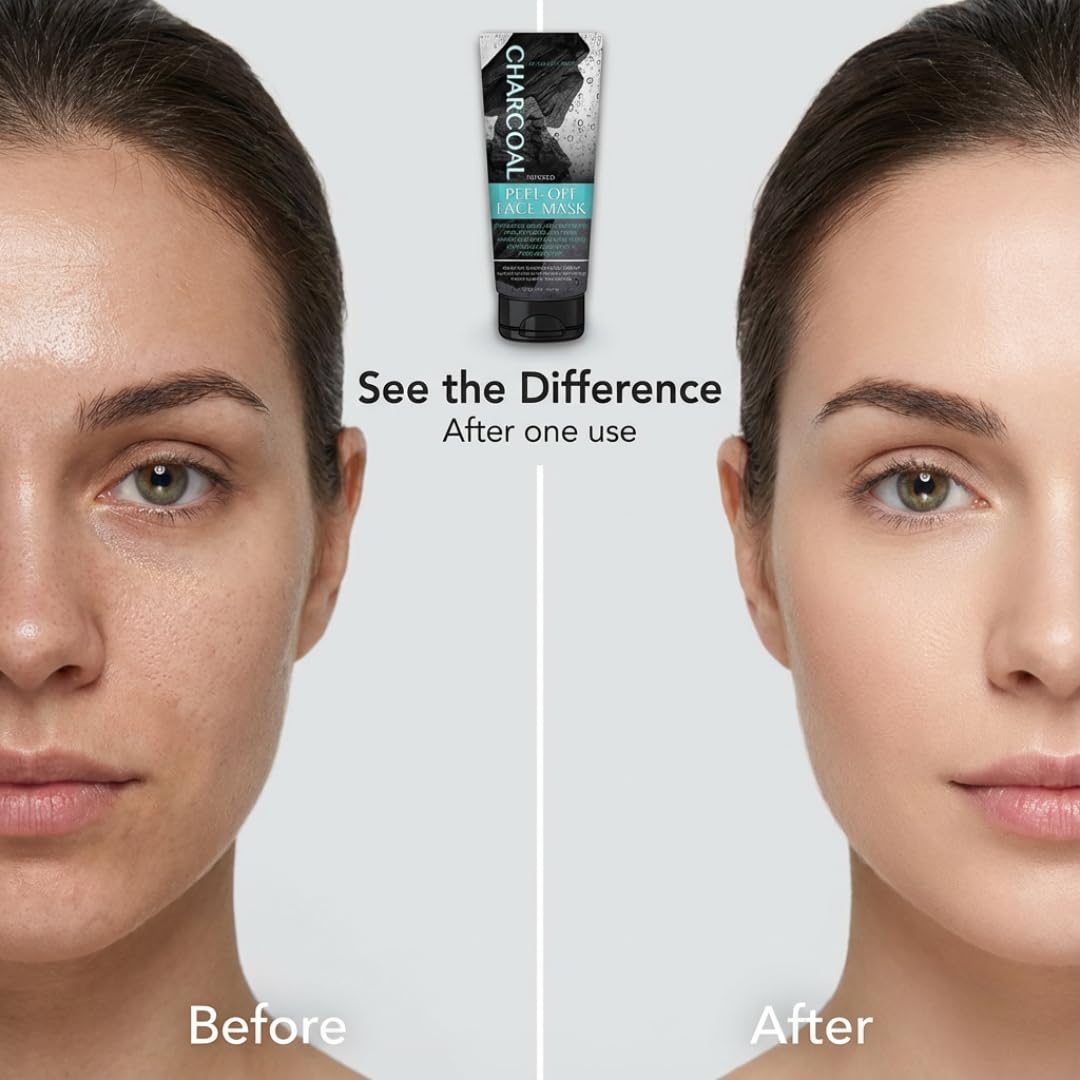 My Beauty Spot Charcoal Face Mask after-peel skin looking clean and refreshed.