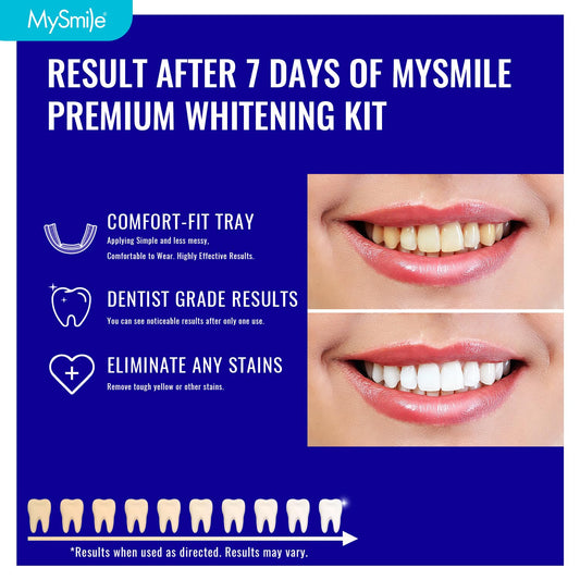 12% hydrogen peroxide whitening gel inside the MySmile kit