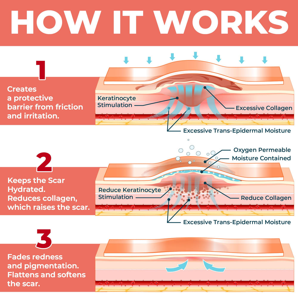 MYHELP reusable scar sheets are washable and long-lasting