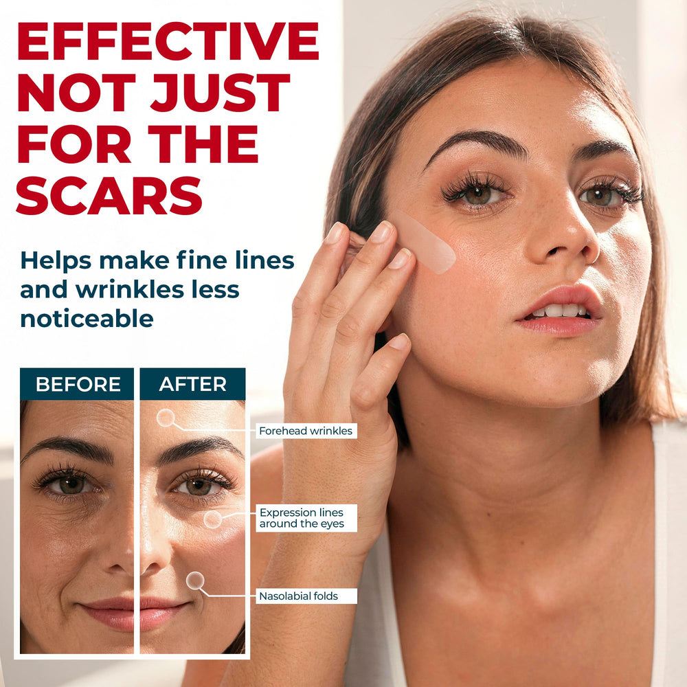 MYHELP scar sheets before-after glimpse hints at smoother scar appearance