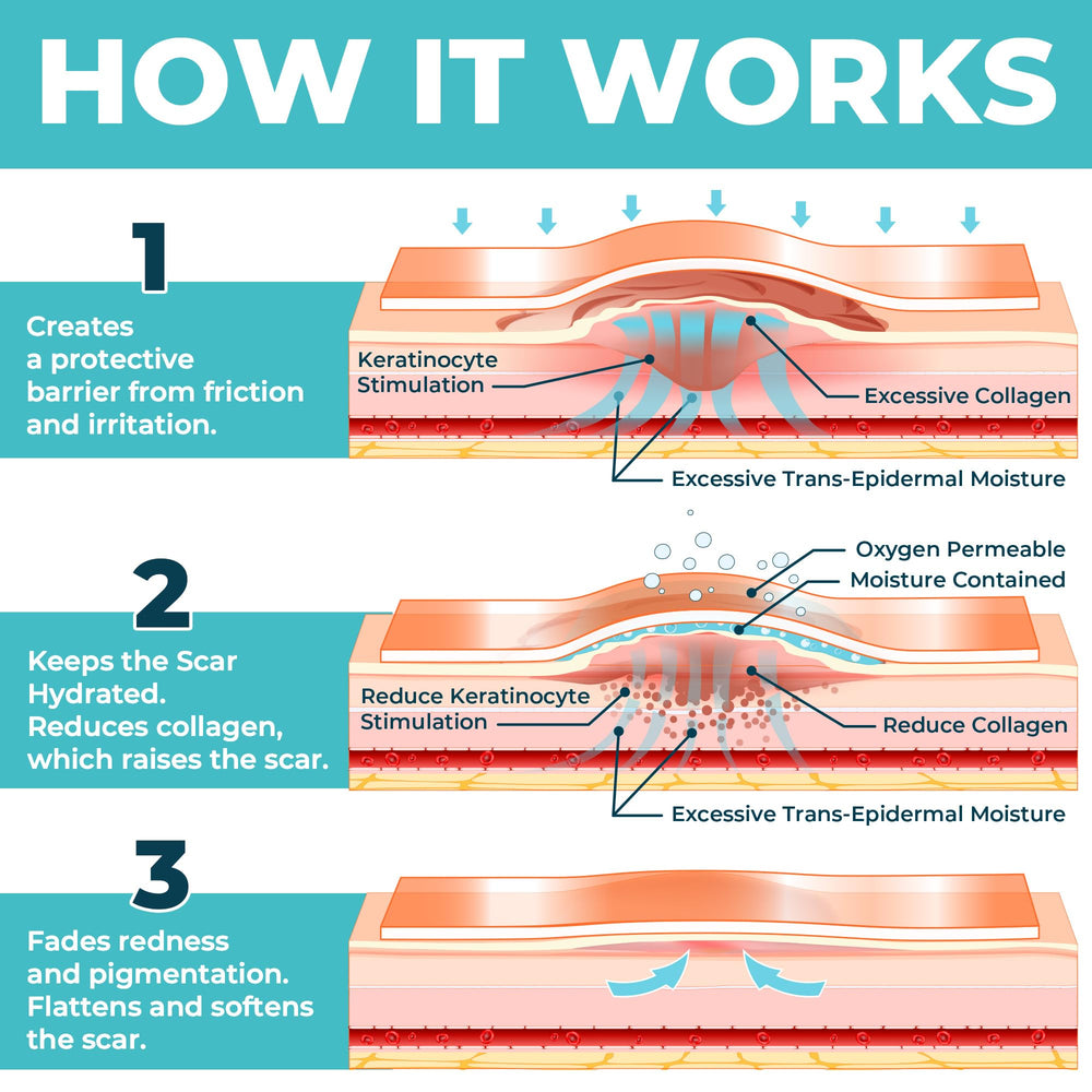 MYHELP scar sheets water-resistant surface withstands moisture during workouts and daily tasks