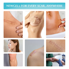 MyNewGel Plus after-use dry finish—skin ready for daily cosmetics.