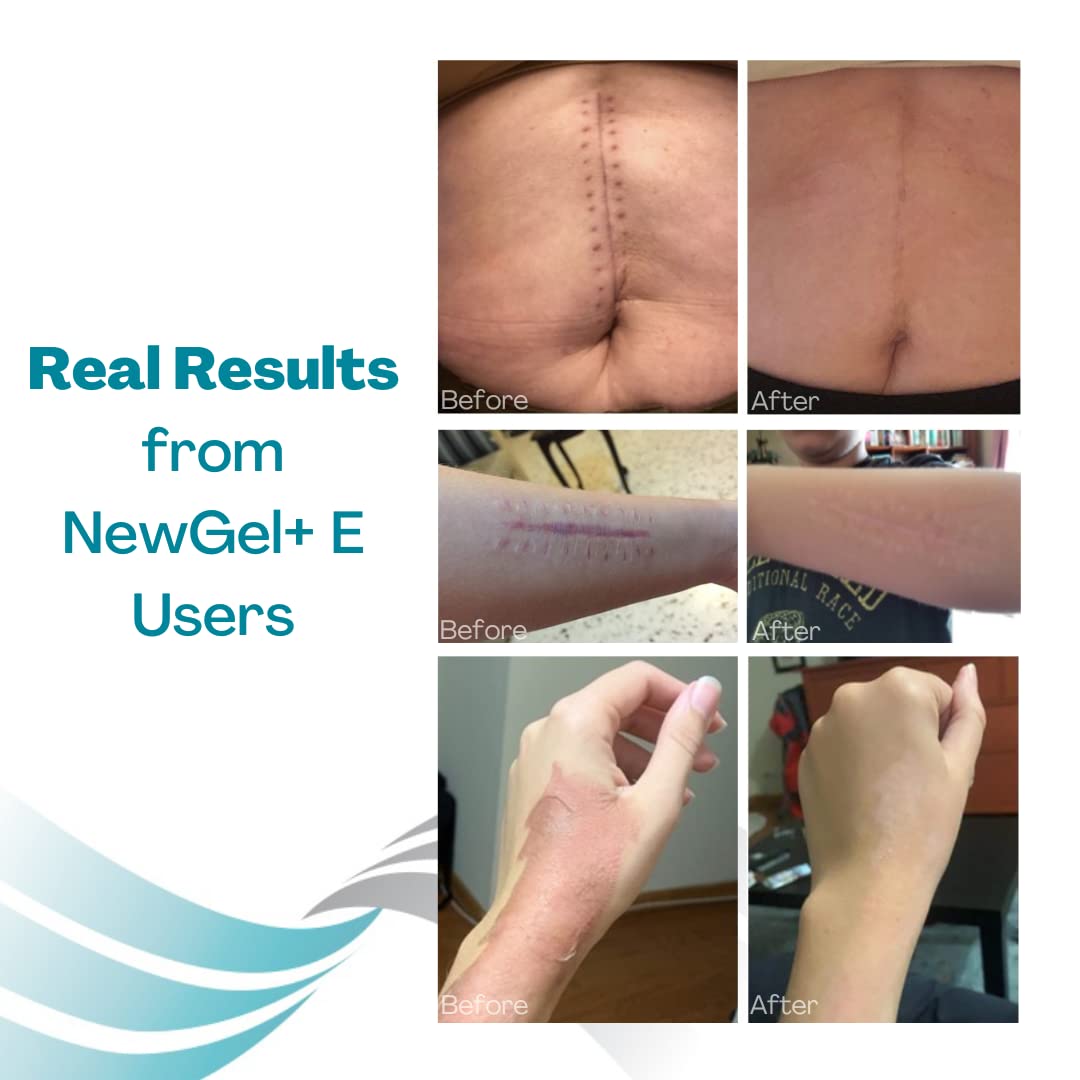 MyNewGel Plus vitamin E ingredient closeup emphasizes nourishing silicone formula.