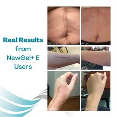 MyNewGel Plus vitamin E ingredient closeup emphasizes nourishing silicone formula.