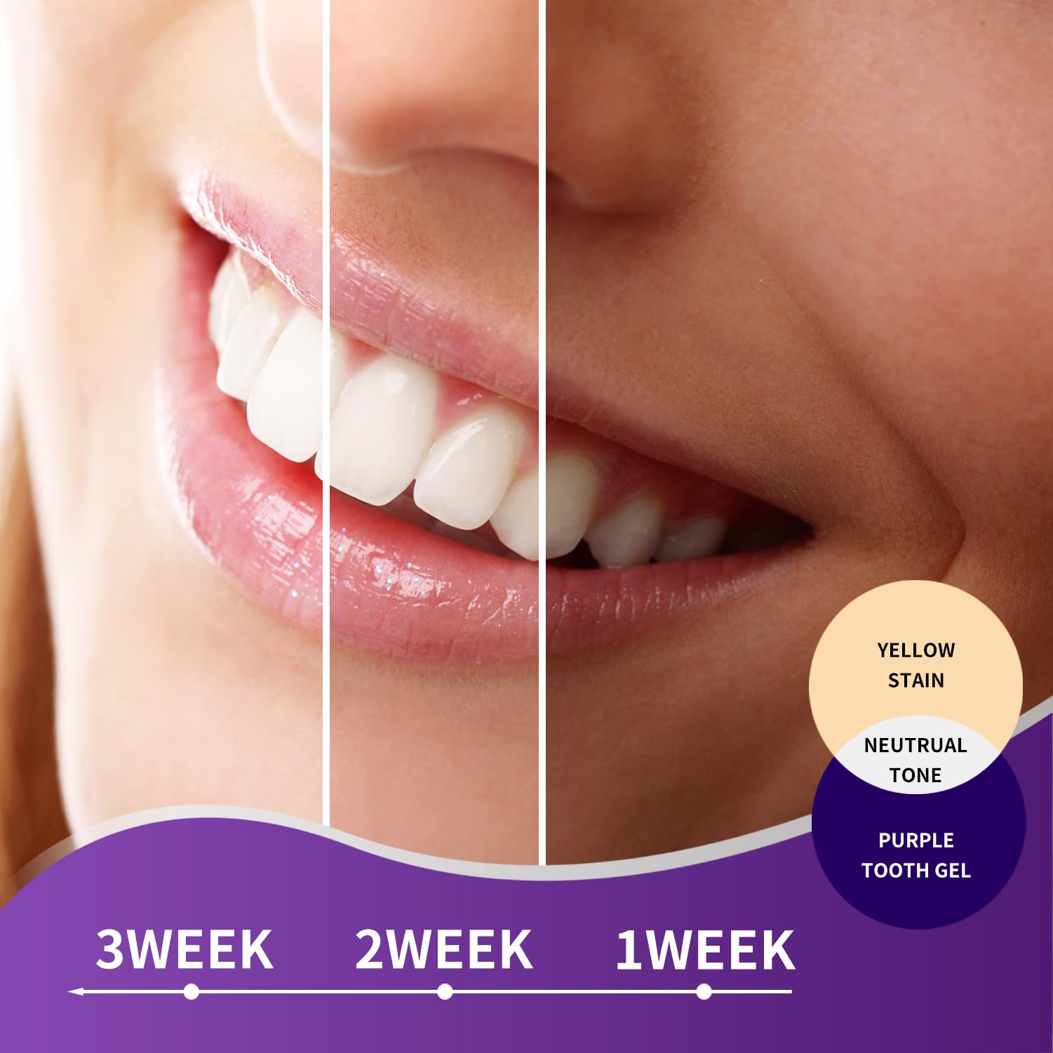 MySmile Purple Toothpaste packaging and branding