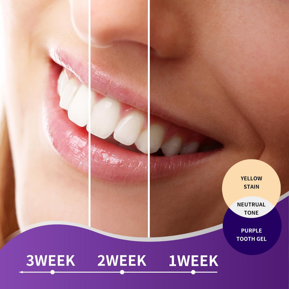 MySmile Purple Toothpaste packaging and branding