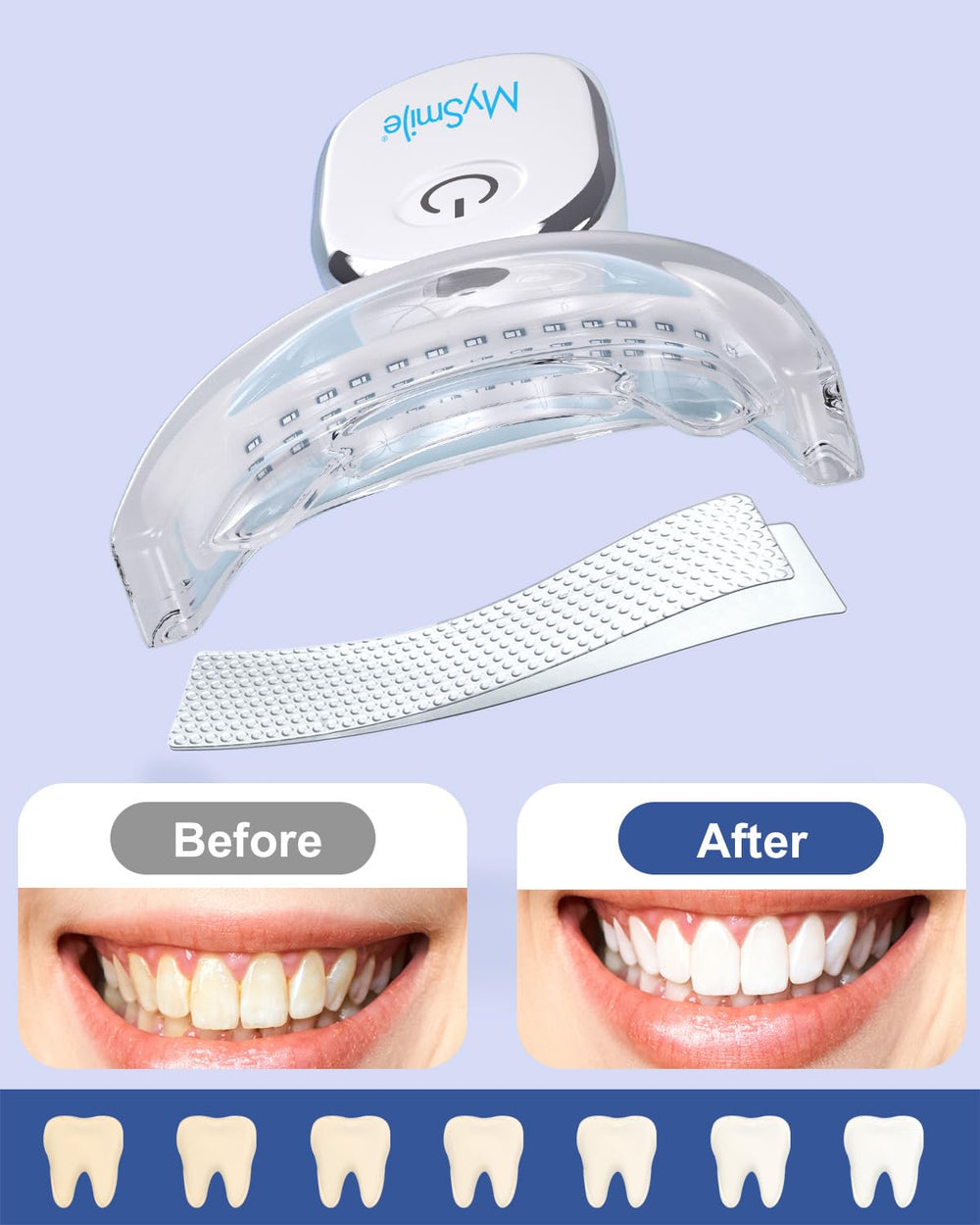 Sensitive-teeth friendly whitening strips from MySmile