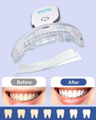 Sensitive-teeth friendly whitening strips from MySmile