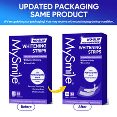 Complete 28-count teeth whitening kit by MySmile