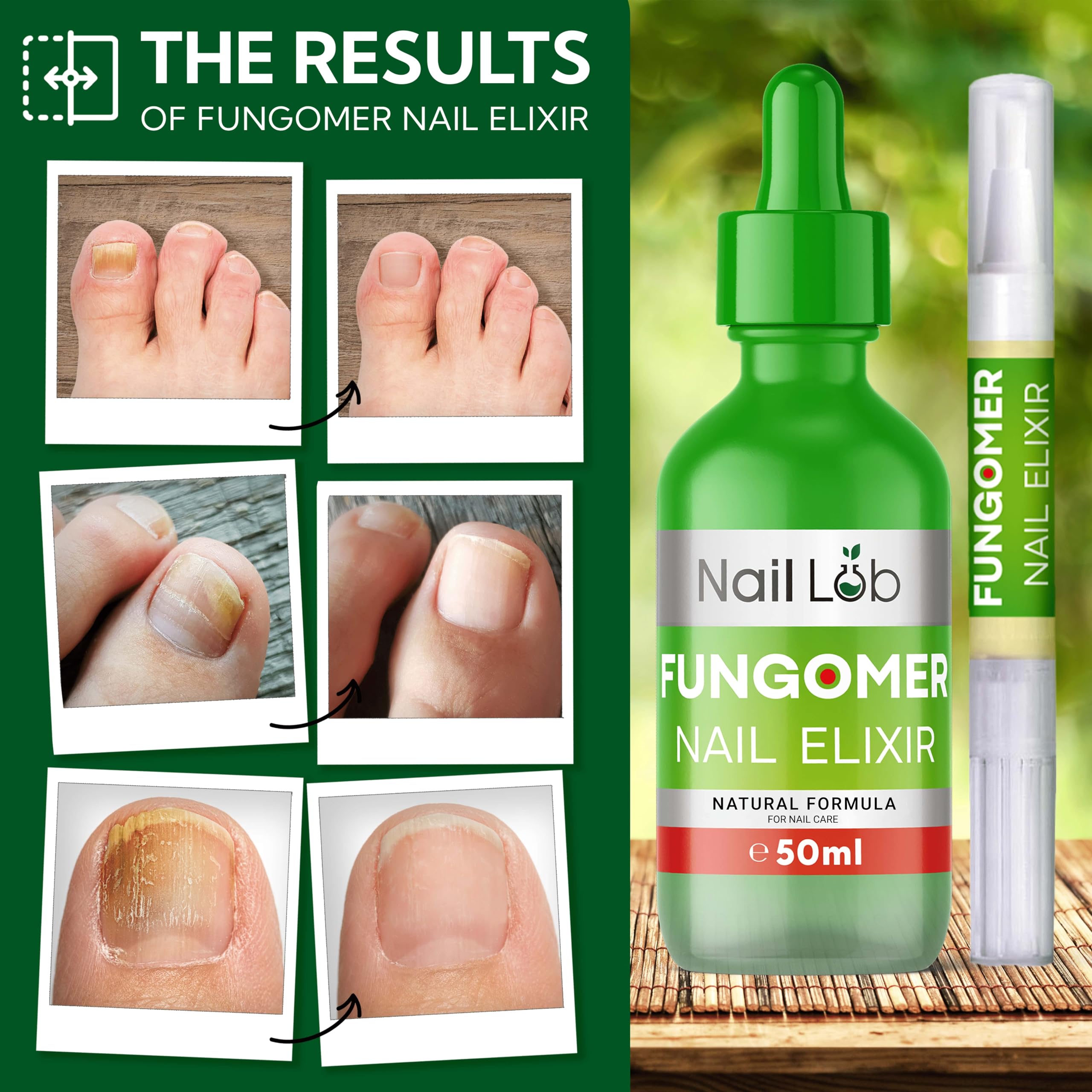 Nail Lab Toenail Fungus Treatment Pen overnight absorption implies convenient nightly routine.