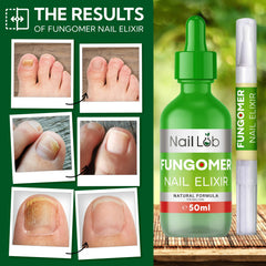 Nail Lab Toenail Fungus Treatment Pen overnight absorption implies convenient nightly routine.