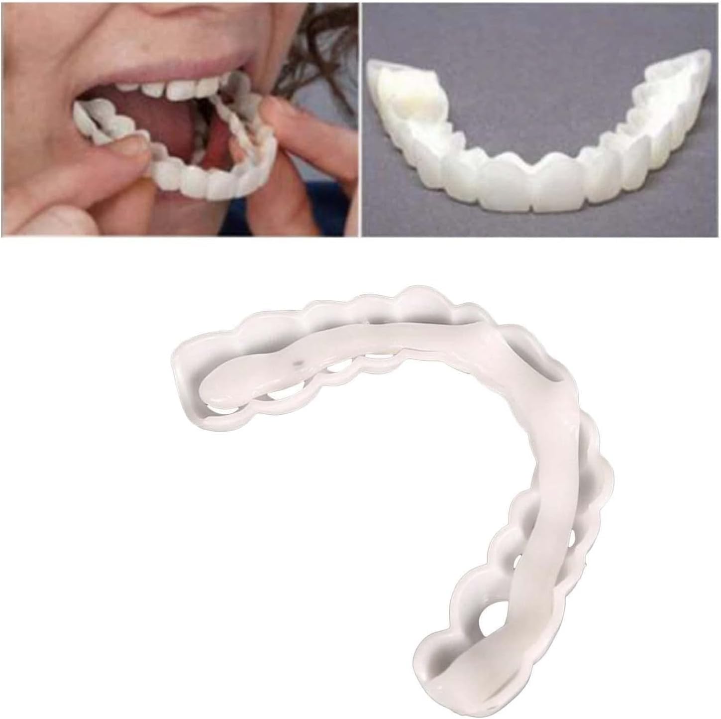 Natural color, nearly invisible smile look