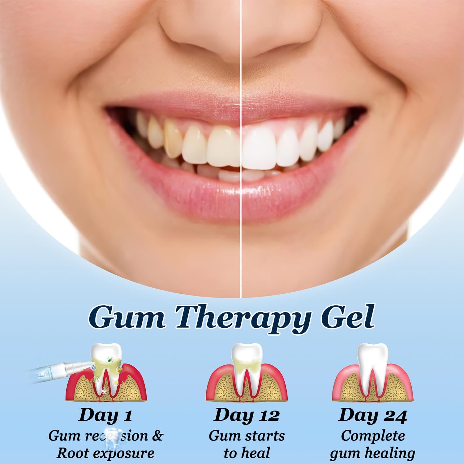 Illustration of gum health and care