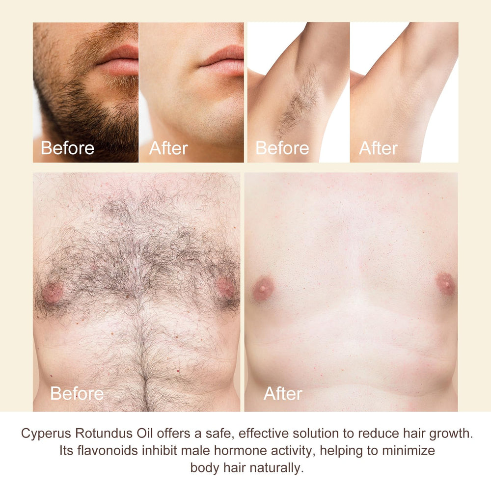NIFEISHI Cyperus Rotundus Oil on legs for quick, non-greasy hydration.