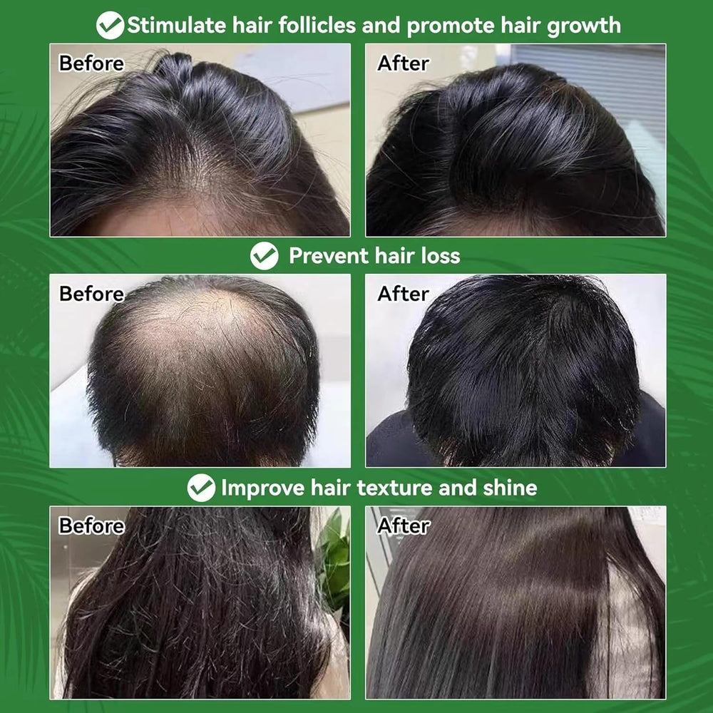 Noni Energy maxgrow thicker-hair-appearance for fuller look.