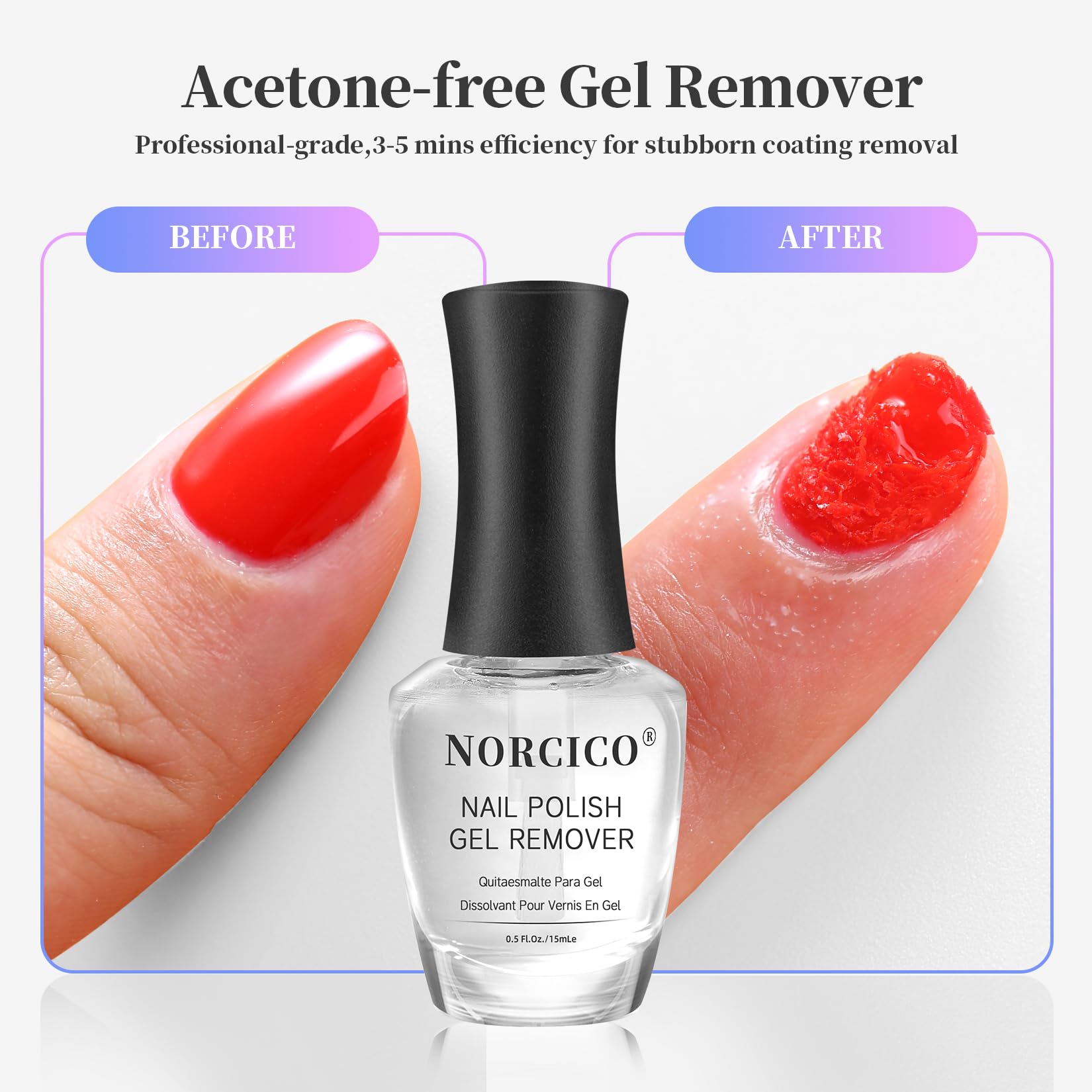 Norico remover kit contents showing file and remover for DIY removal.