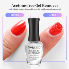 Norico remover kit contents showing file and remover for DIY removal.