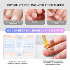 NORCICO nails after removal show salon-smooth finish at home.