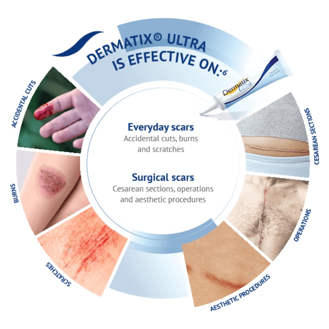 NOUVOS Dermatix Ultra applicator closeup demonstrates precise gel application