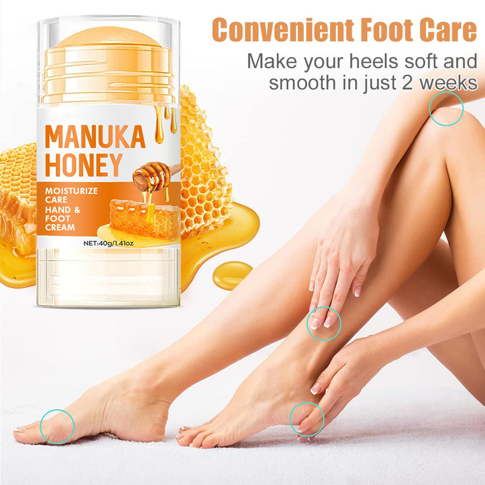 NovaCharm elbows, knees, and hands care using rich urea cream.