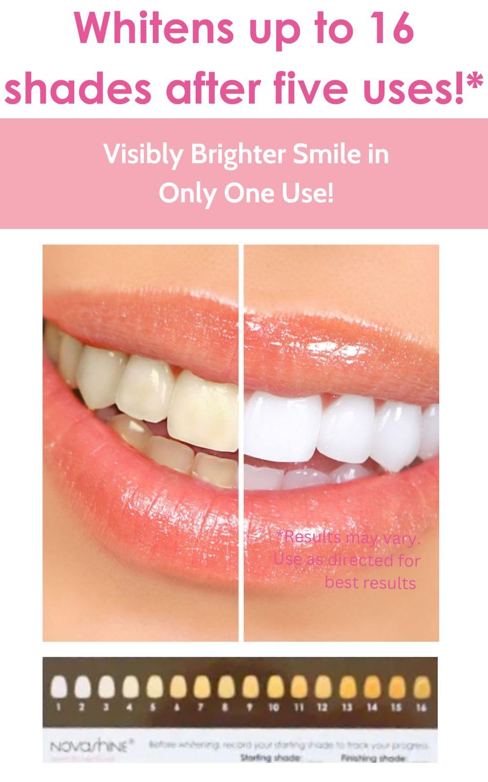 Blue LED whitening light from the Novashine kit