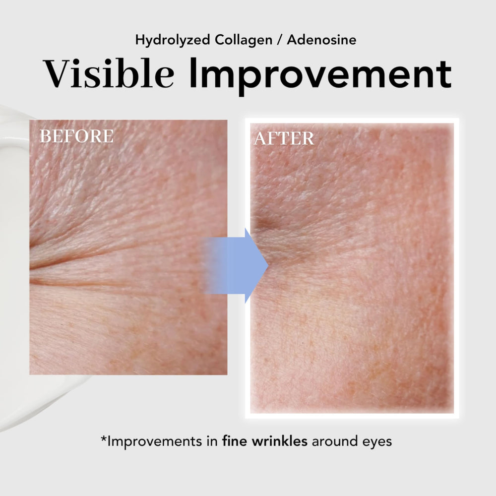 NOWATER Beta-glucan formula illustration highlighting soothing, moisturized under-eye skin.