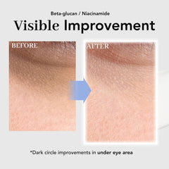 NOWATER Collagen Eye Cream smooth texture improving fine wrinkles around the eyes.