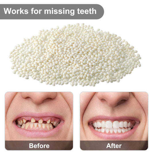 Bead teeth pellets ready for molding and DIY dental repair